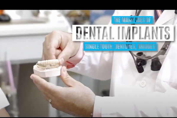 doctor discussing dental implants in Pasadena